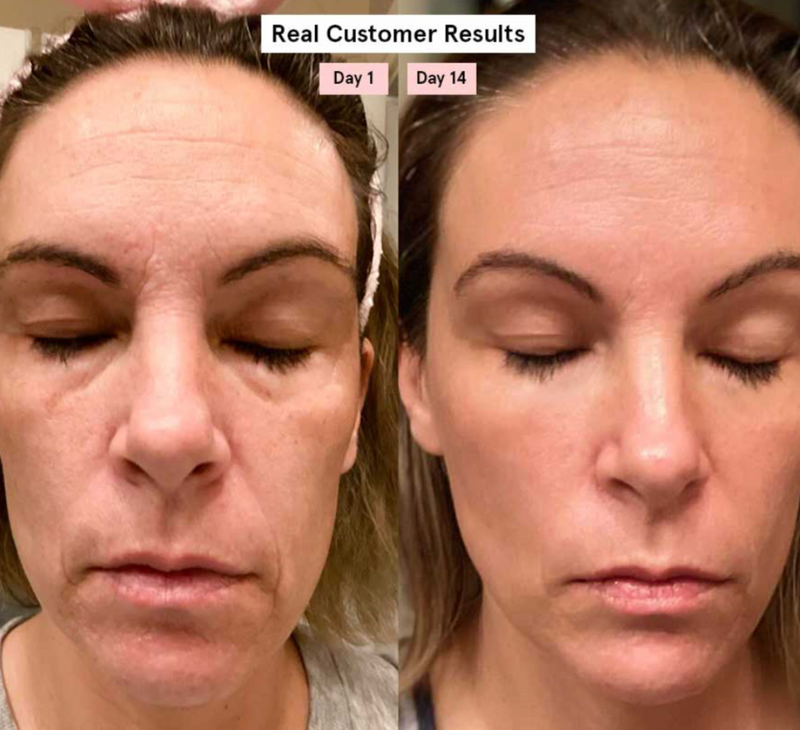 Dermawand Pro Aparato De Cuidado De La Piel